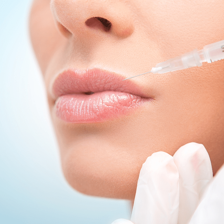 Get the Perfect Pout with the Botox Lip Flip: A Non-Invasive Solution