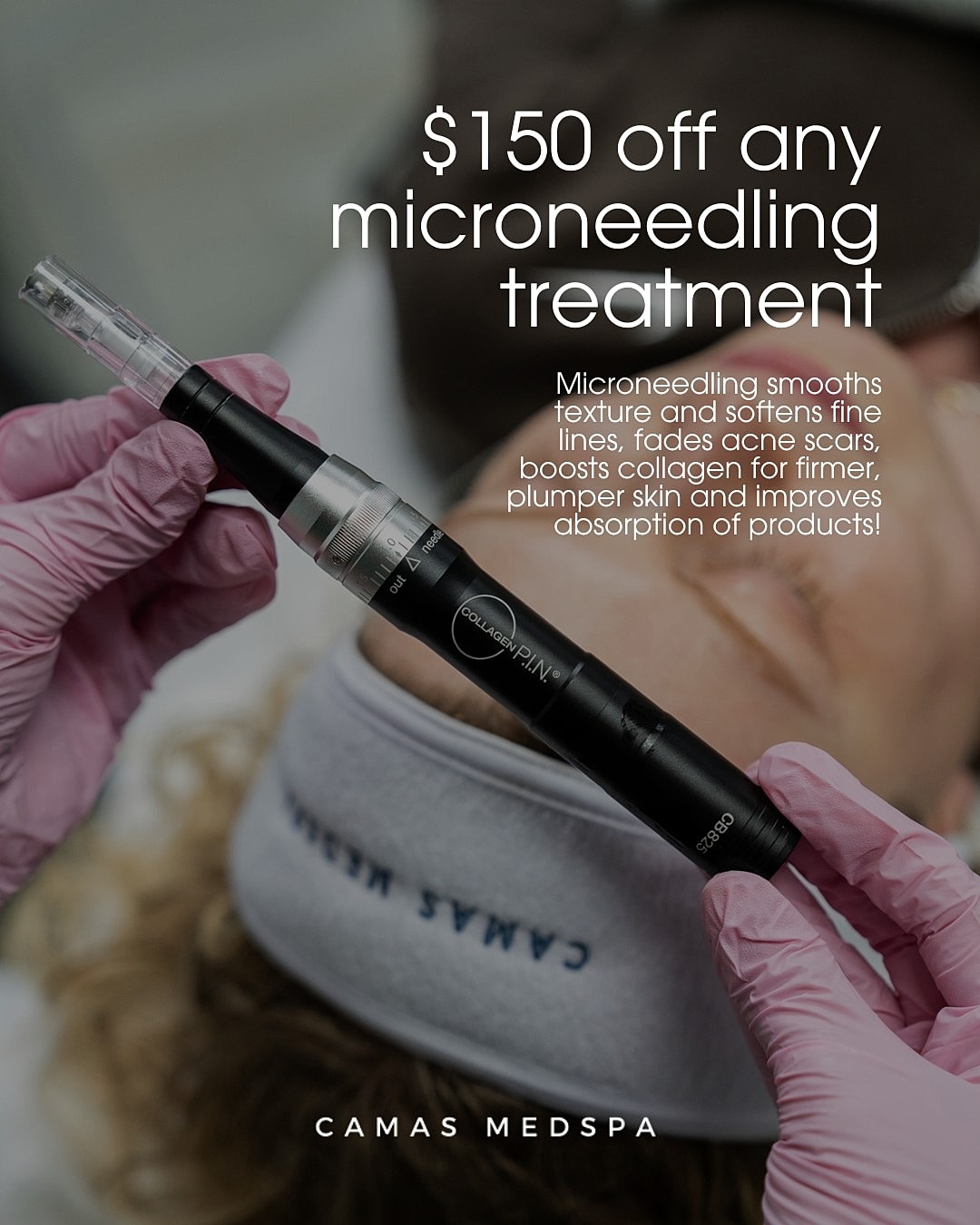 $150 off microneedling treatment at Camas Medspa